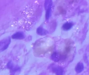 microplásticos en el cerebro